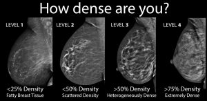 breast-density-4-levels